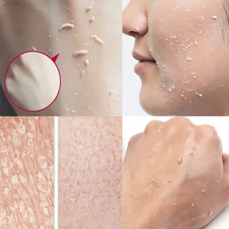 Orange Exfoliating Peeling Gel – обзор и цена Ceramide Moisturizer