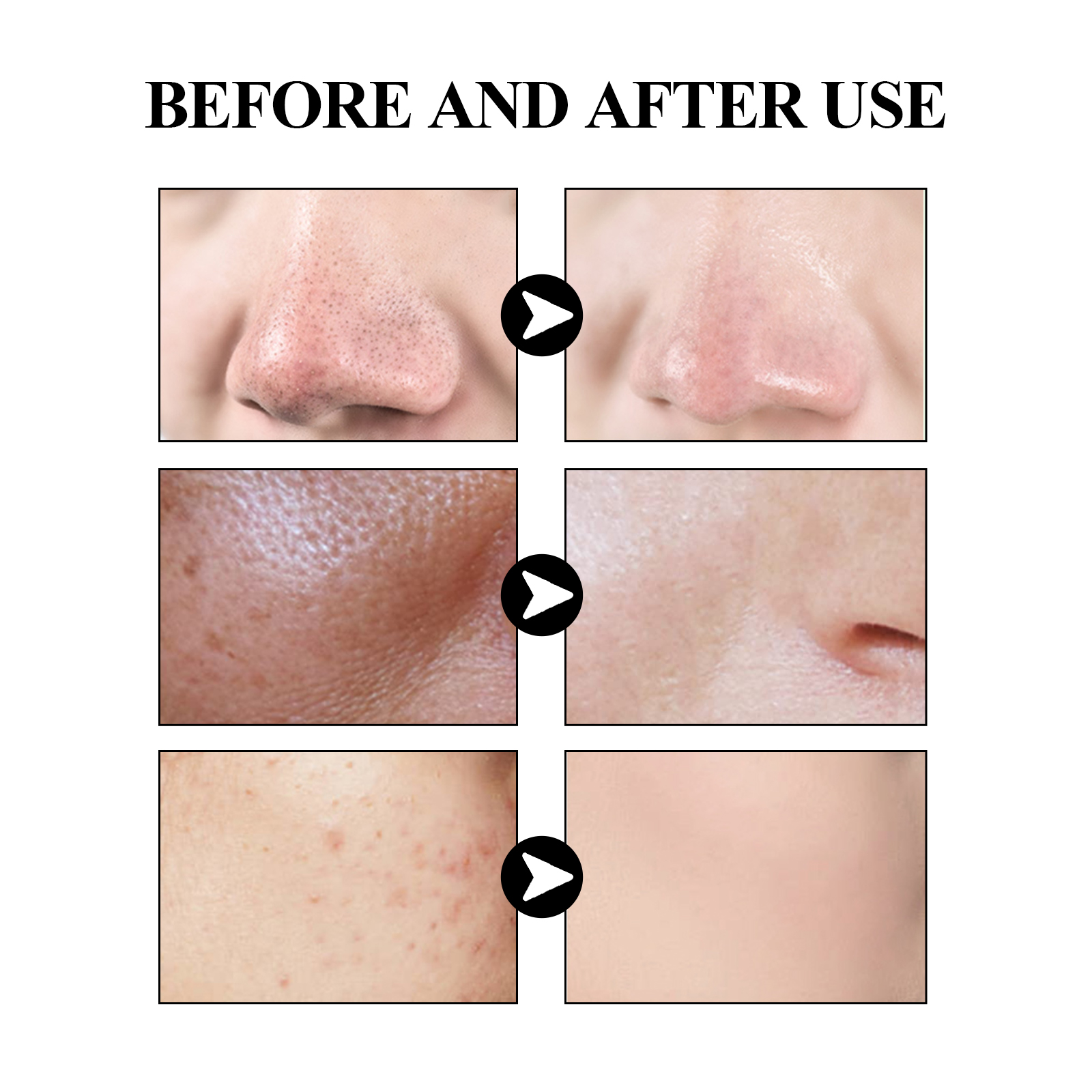 40g Activated carbon facial ma – обзор и цена Mud Mask Kaolin